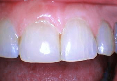 Dr. Murphy Medium After